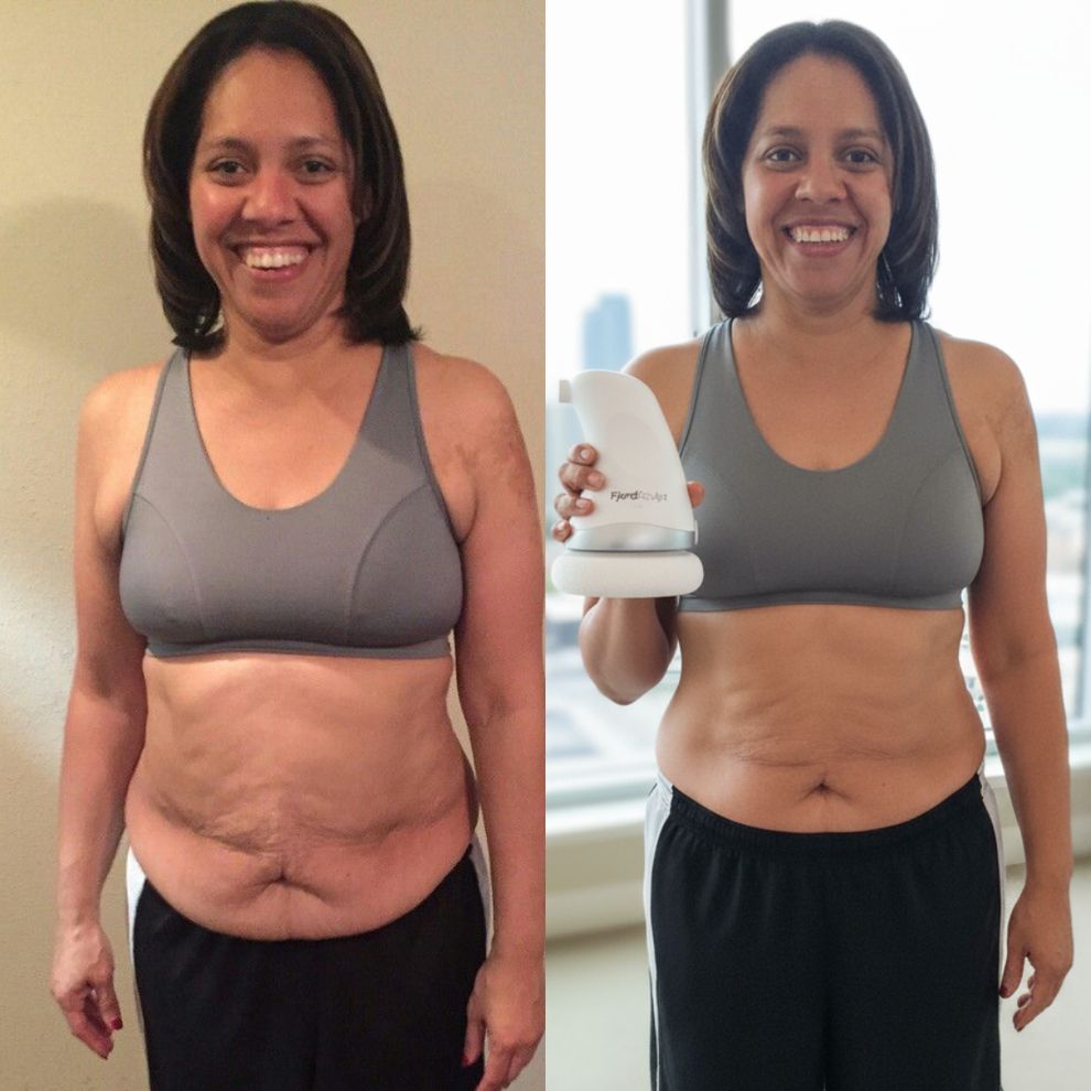 Frenchi®-Sculpteur corporel